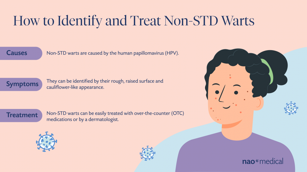 How to Identify and Treat Non-STD Warts
